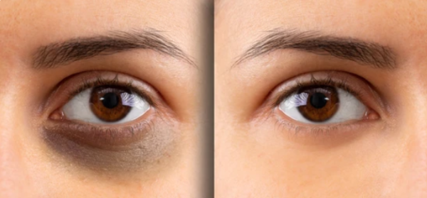 HC Miracle Repair Eye Gel - Image 2